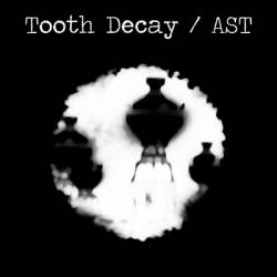 AST : Ast - Tooth Decay AST : Ast - Tooth Decay